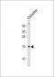 Zebrafish gabarapa Antibody (N-Term)